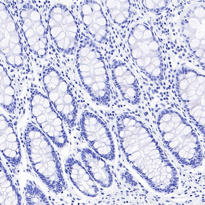 MDR3 Recombinant Rabbit mAb (SDT-1949-60)