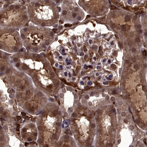 p38 delta/MAPK13 + p38 alpha/MAPK14 Recombinant Mouse mAb (S-3860)