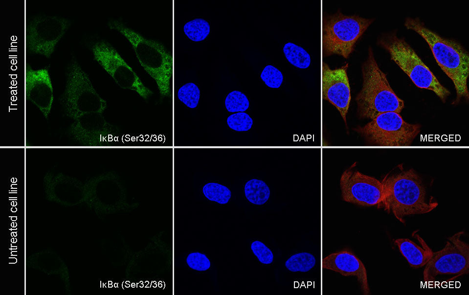 Phospho-IκBα (Ser32/36) Recombinant Rabbit mAb (S-R362)