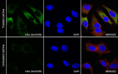 Phospho-IκBα (Ser32/36) Recombinant Rabbit mAb (S-R362)