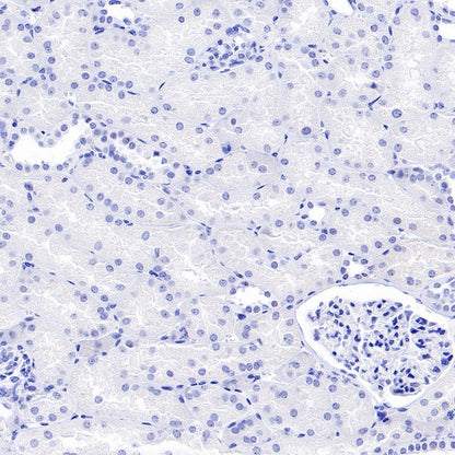 Nanog Recombinant Rabbit mAb (S-1823-8)