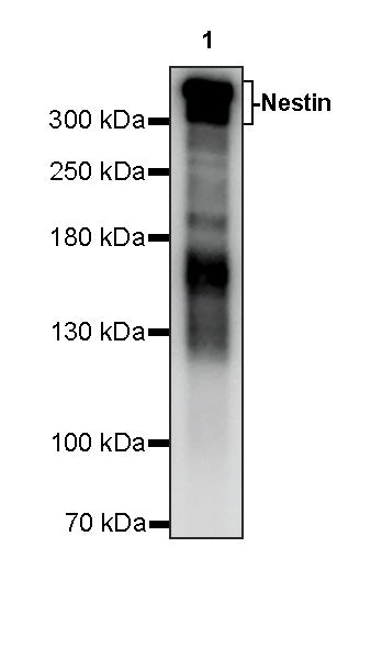 Nestin Recombinant Rabbit mAb (S-5471)
