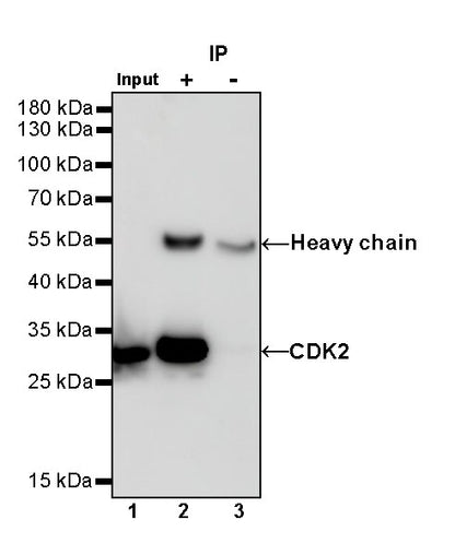 CDK2 Recombinant Rabbit mAb (S-1308-13)