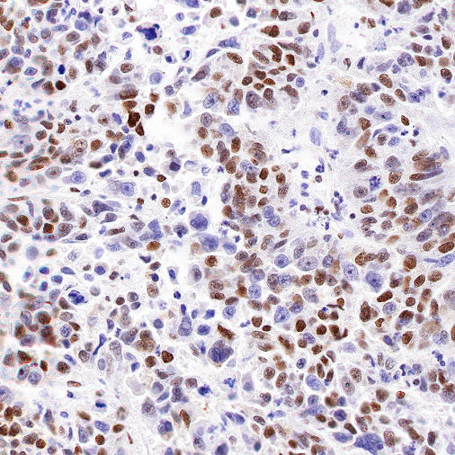 nmt55/p54nrb Recombinant Rabbit mAb (S-1745-48)