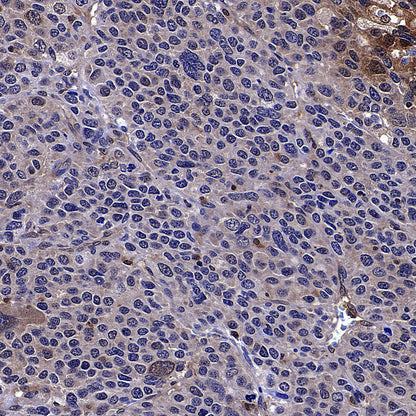 PGK1 Mouse mAb