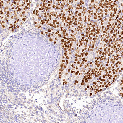 BRN3A Recombinant Rabbit mAb (S-3253-25)