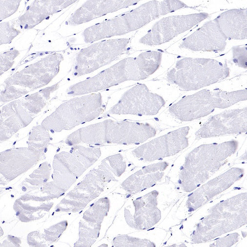 Human IgA1 Rabbit Polyclonal Antibody