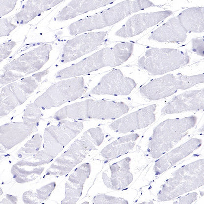 Human IgA1 Rabbit Polyclonal Antibody