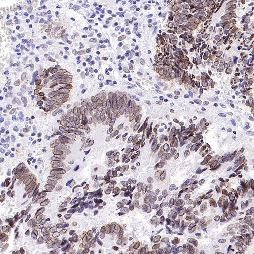 RanBP2 Recombinant Rabbit mAb (S-2593-310)
