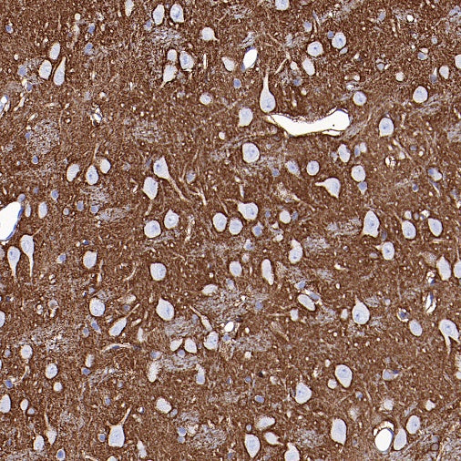 CBS Rabbit Polyclonal Antibody