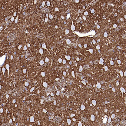 CBS Rabbit Polyclonal Antibody