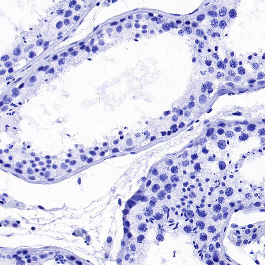 xCT Recombinant Rabbit mAb (S-5531)