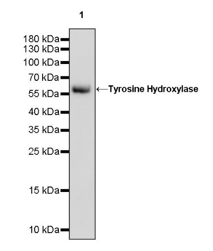 Tyrosine Hydroxylase Recombinant Rabbit mAb (S-1001-26)