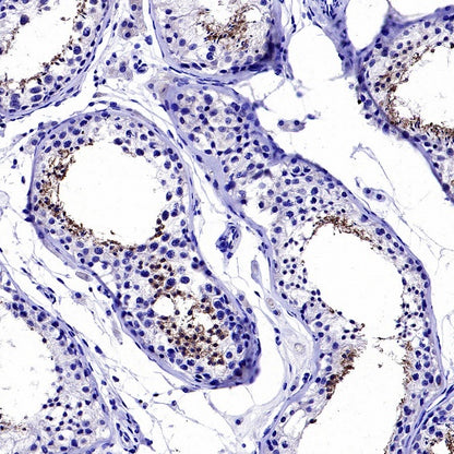Hyaluronidase PH20/SPAM1 Recombinant Rabbit mAb (S-2143-20)