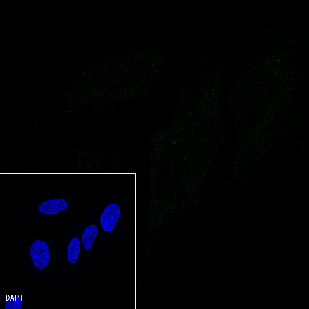CDX2 Recombinant Rabbit mAb (SDT-134-76)