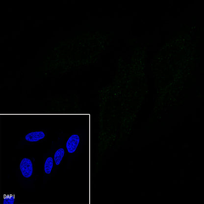 CDX2 Recombinant Rabbit mAb (SDT-134-76)