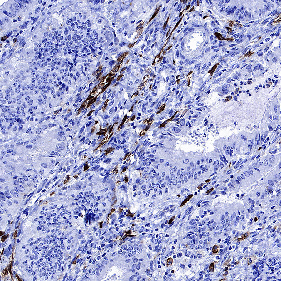 CD206 Recombinant Rabbit mAb (S-3477-27)