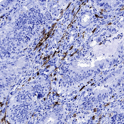 CD206 Recombinant Rabbit mAb (S-3477-27)