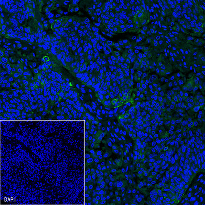 S-RMab® PD-L1 Recombinant Rabbit mAb (SDT-119-16)