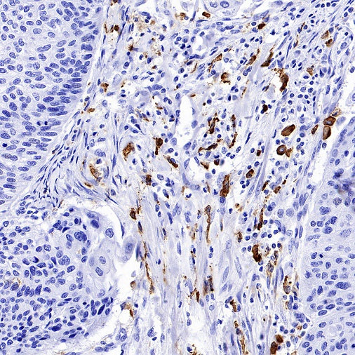 Mannose Receptor Recombinant Rabbit mAb (SDT-2206-52)