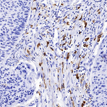 Mannose Receptor Recombinant Rabbit mAb (SDT-2206-52)