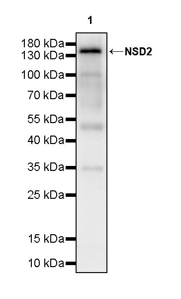NSD2 Recombinant Rabbit mAb (S-4013-46)