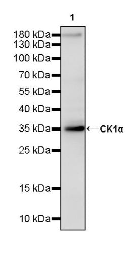 CK1α Recombinant Rabbit mAb (SDT-2884-60)