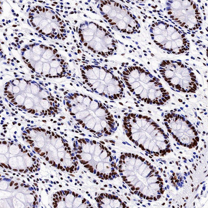 KAP-1 Recombinant Rabbit mAb (S-986-5)