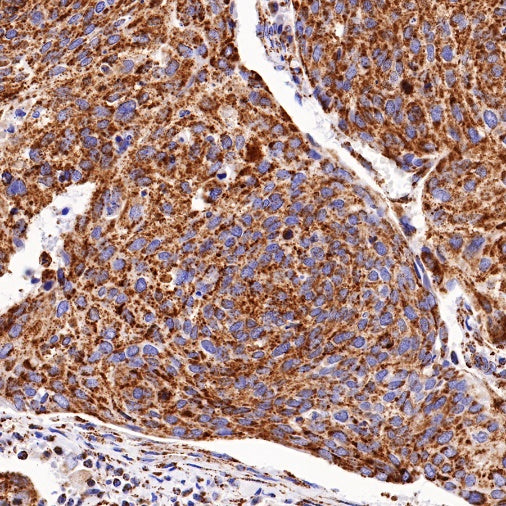 PBR/TSPO Recombinant Rabbit mAb (S-607-19)