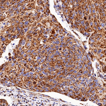 PBR/TSPO Recombinant Rabbit mAb (S-607-19)