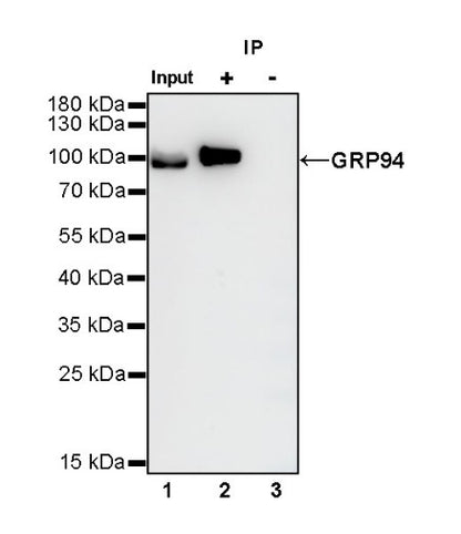 GRP94 Recombinant Rabbit mAb (S-R268)