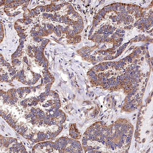 IGF2BP2 Rabbit Polyclonal Antibody
