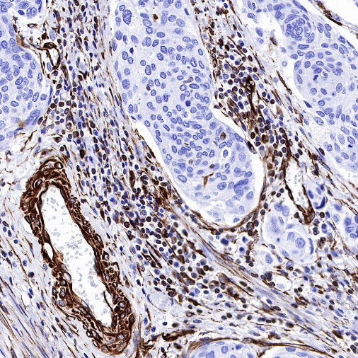 Vimentin Recombinant Rabbit mAb (SDT-029-120)