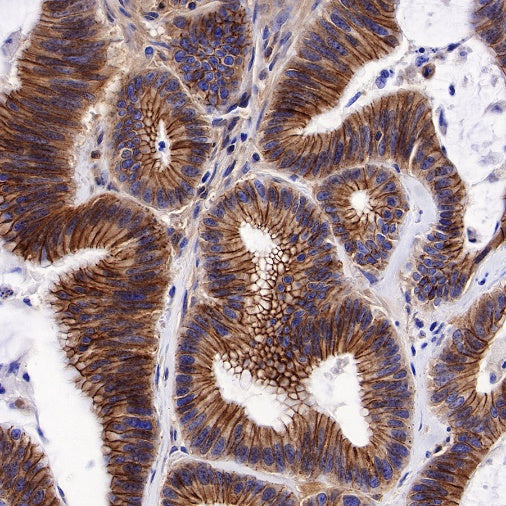 E-Cadherin Recombinant Rabbit mAb (SDT-438-45)