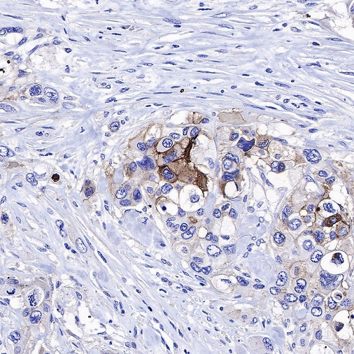 5T4 Recombinant Rabbit mAb (S-R361)
