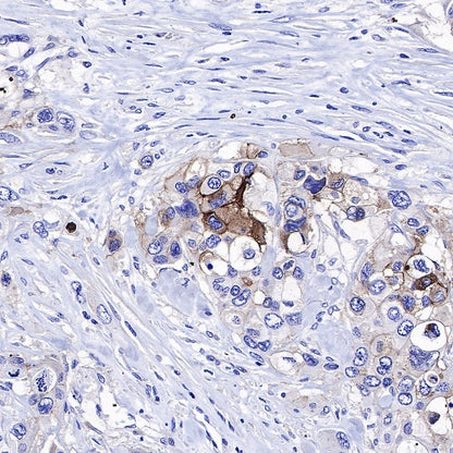 5T4 Recombinant Rabbit mAb (S-R361)