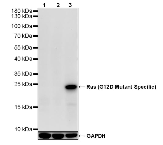 Ras (G12D Mutant Specific) Recombinant Rabbit mAb (S-5958)