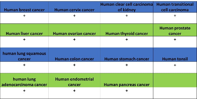 Superoxide Dismutase 1 Recombinant Rabbit mAb (S-1537-39)