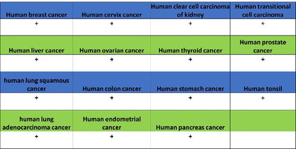 Superoxide Dismutase 1 Recombinant Rabbit mAb (S-1537-39)