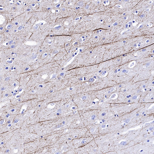 Neurofilament H Recombinant Rabbit mAb (S-532-103)