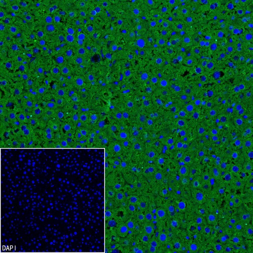 ALDH1L1 Recombinant Rabbit mAb (S-2885-49)