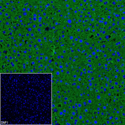 ALDH1L1 Recombinant Rabbit mAb (S-2885-49)