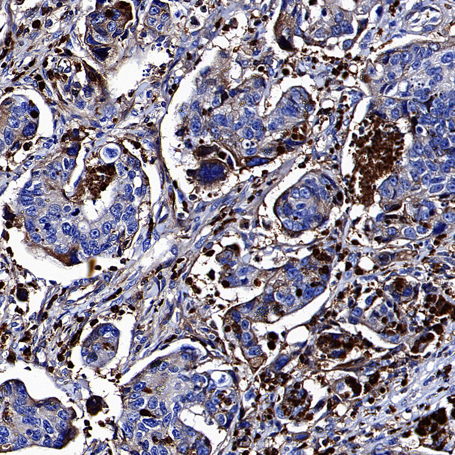 MMP-8 Recombinant Rabbit mAb (S-5674)