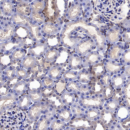 TRIM21 Mouse mAb (S-M0045)