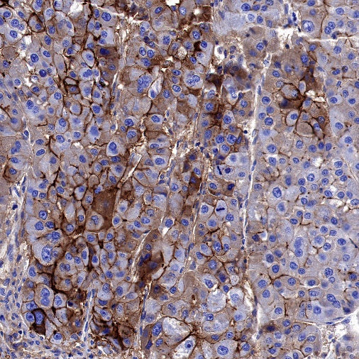 ICAM-1/CD54 Recombinant Rabbit mAb (S-906-48)
