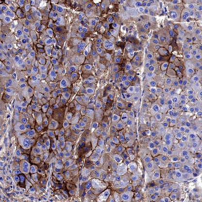 ICAM-1/CD54 Recombinant Rabbit mAb (S-906-48)