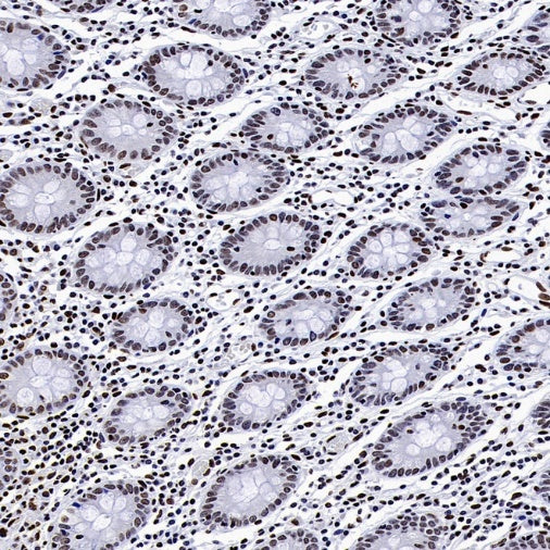 Histone H4 (Lactyl K8) Recombinant Rabbit mAb (S-3243-36)