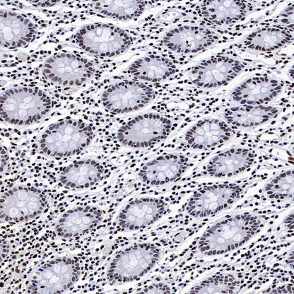 Histone H4 (Lactyl K8) Recombinant Rabbit mAb (S-3243-36)