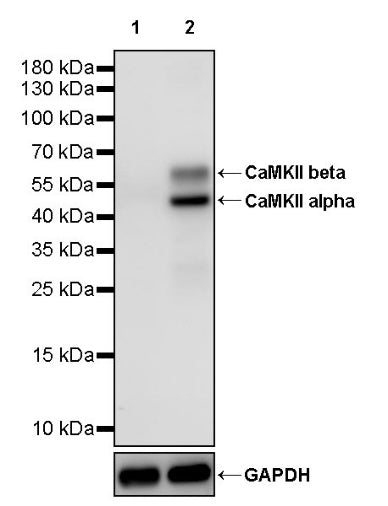 CaMKII alpha Recombinant Rabbit mAb (S-2451-54)