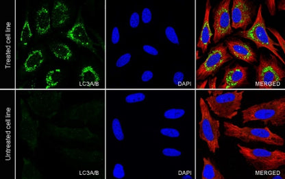 LC3A/B Recombinant Rabbit mAb (S-1367-104)